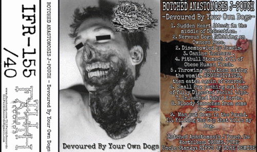 Botched Anastomosis J-Pouch : Devoured by Your Own Dogs